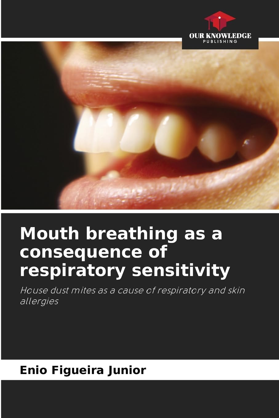 Mouth breathing as a consequence of respiratory sensitivity Medicine
