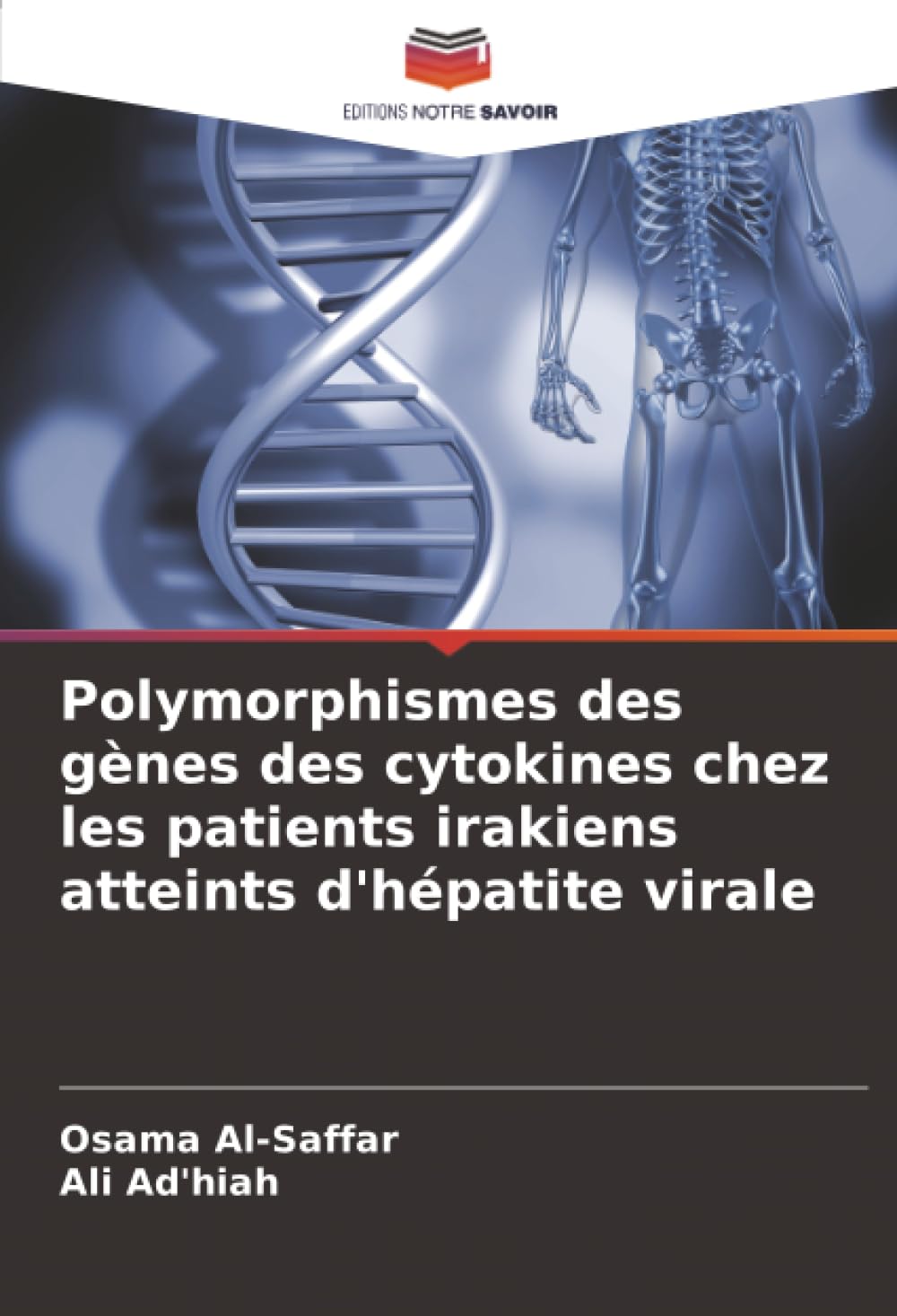 Polymorphismes des gènes des cytokines chez les patients irakiens atteints d'hépatite virale Natural Sciences