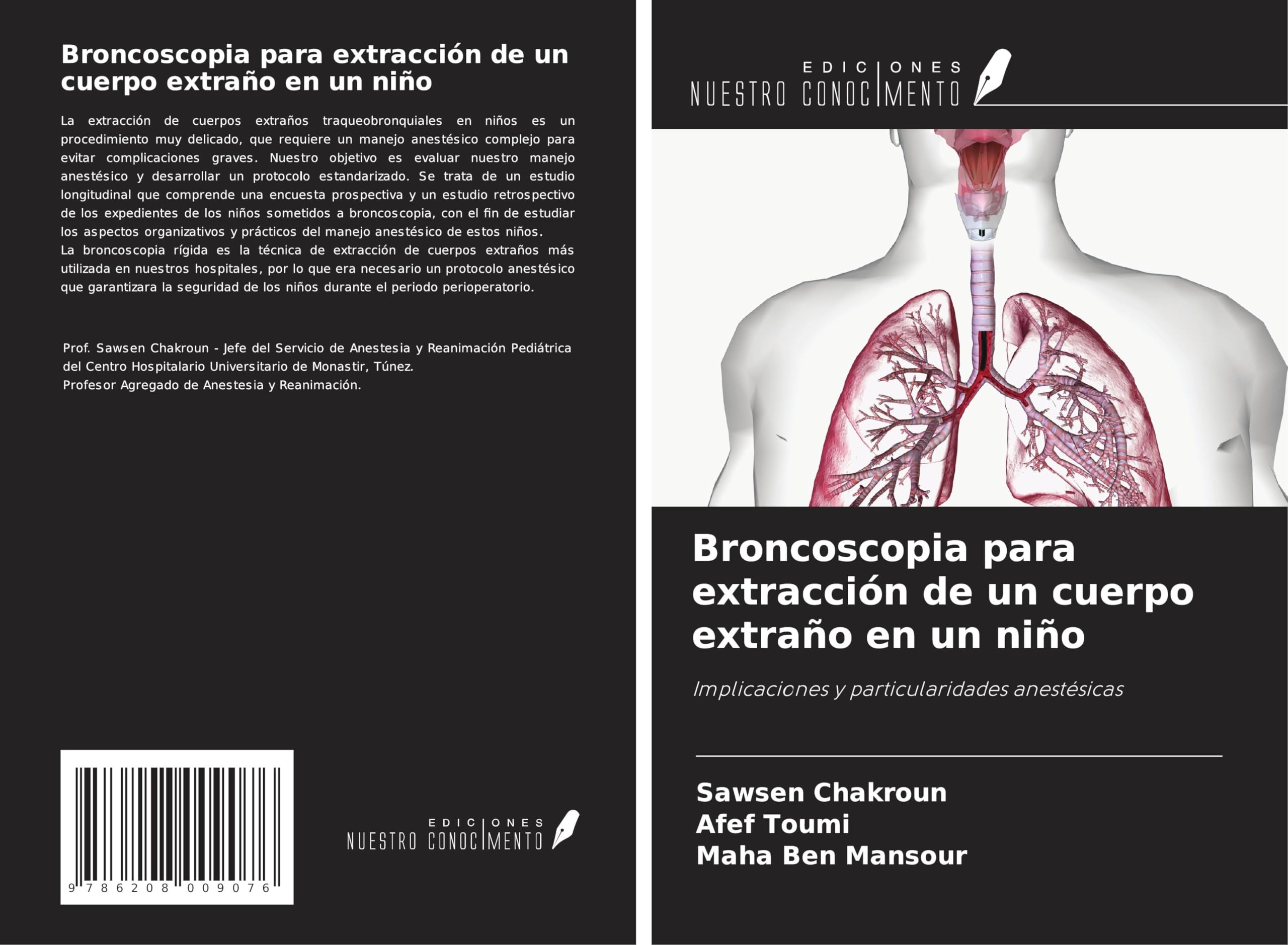 Broncoscopia para extracción de un cuerpo extraño en un niño Medicine