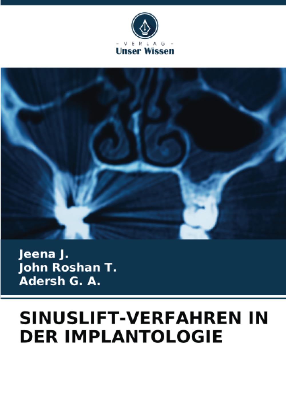 SINUSLIFT-VERFAHREN IN DER IMPLANTOLOGIE Medicine