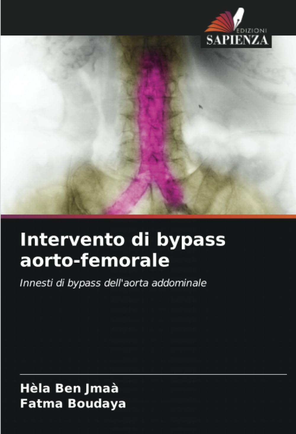 Intervento di bypass aorto-femorale Medicine