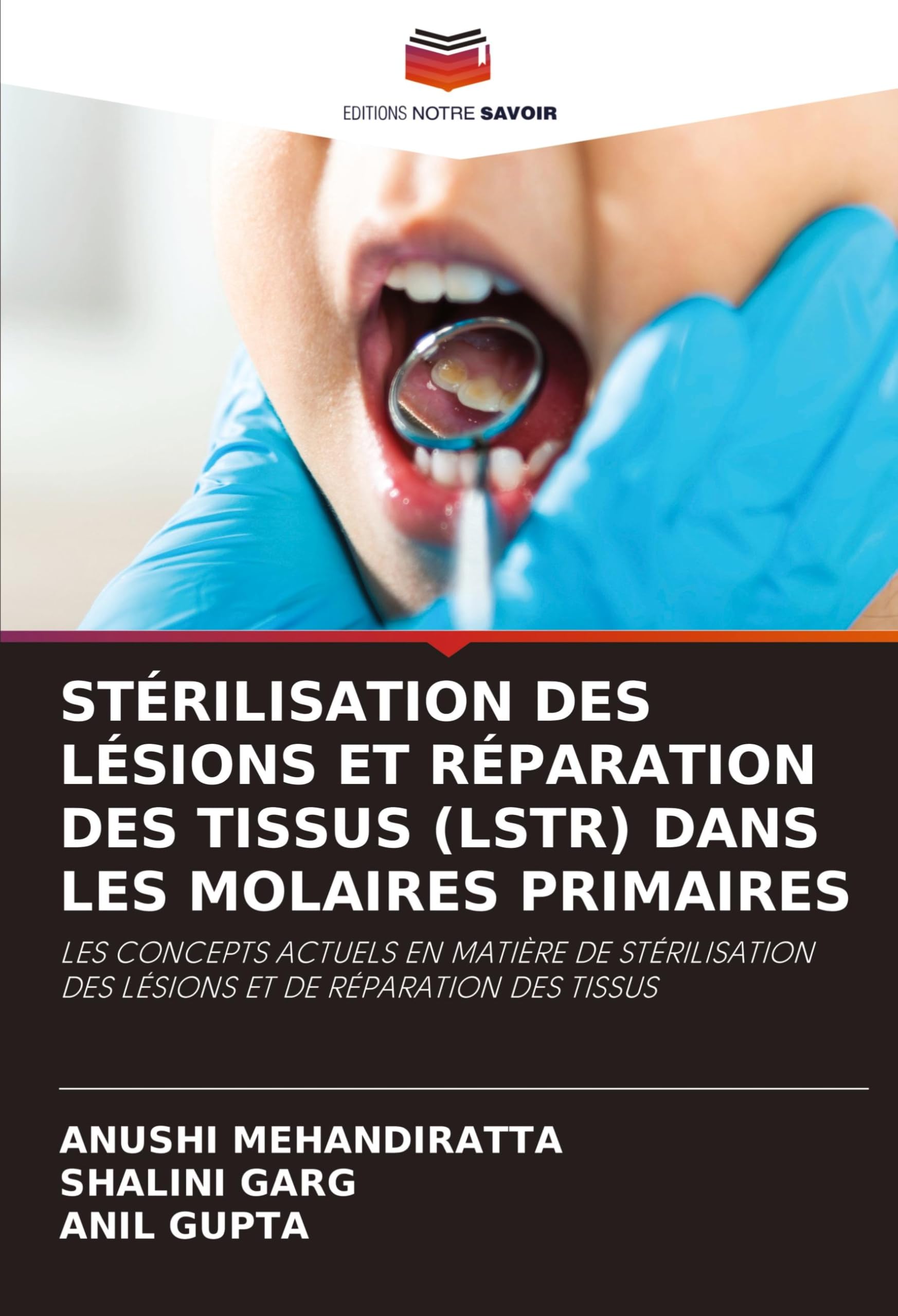 Stérilisation Des Lésions Et Réparation Des Tissus (Lstr) Dans Les Molaires Primaires book