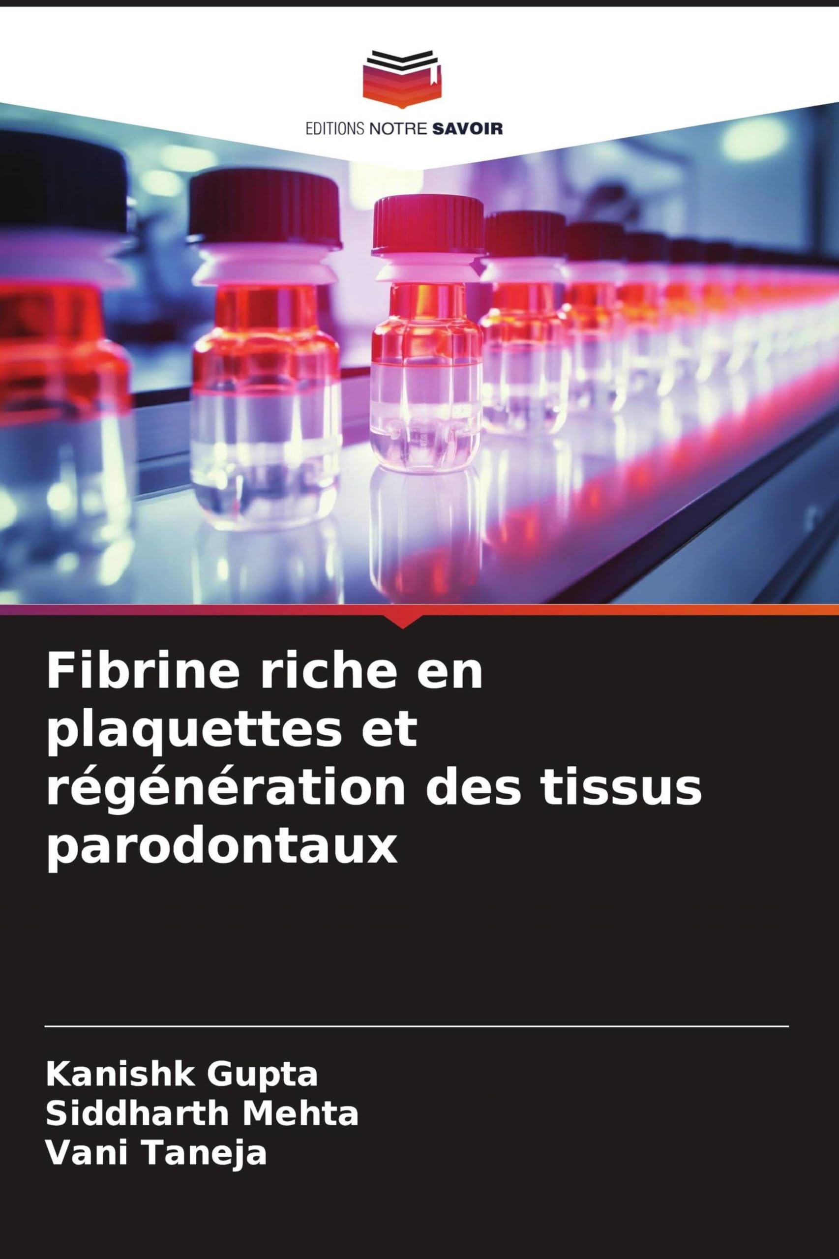 Fibrine riche en plaquettes et régénération des tissus parodontaux Medicine
