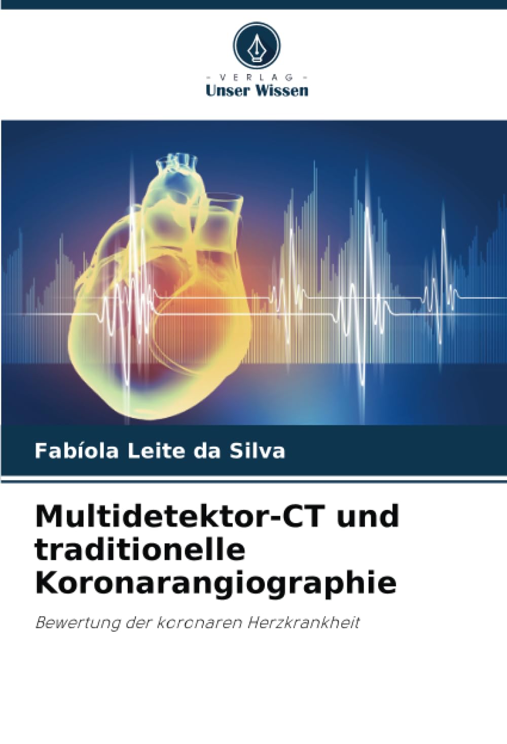 Multidetektor-CT und traditionelle Koronarangiographie: Bewertung der koronaren Herzkrankheit Medicine