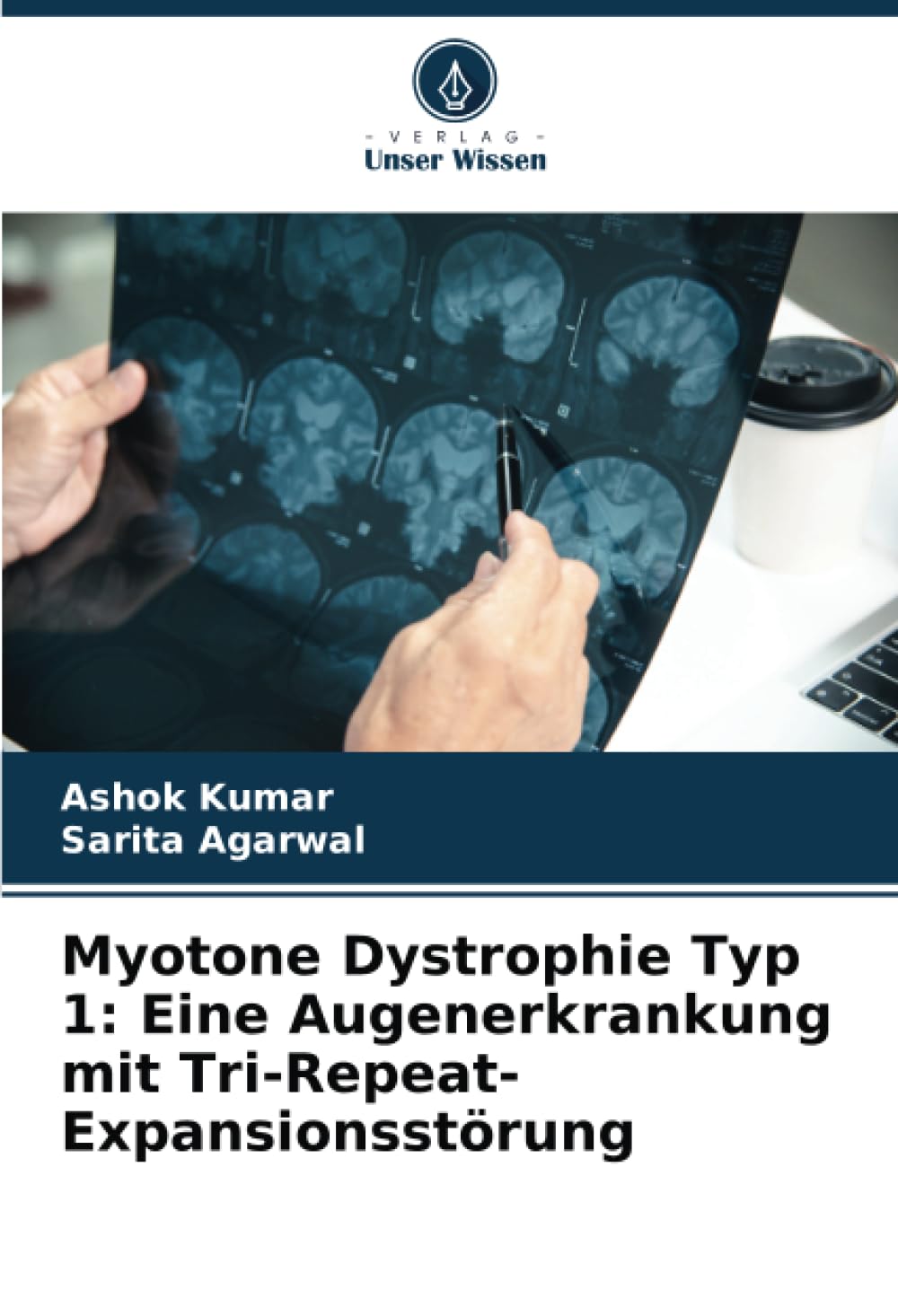Myotone Dystrophie Typ 1: Eine Augenerkrankung mit Tri-Repeat-Expansionsstörung: DE Natural Sciences