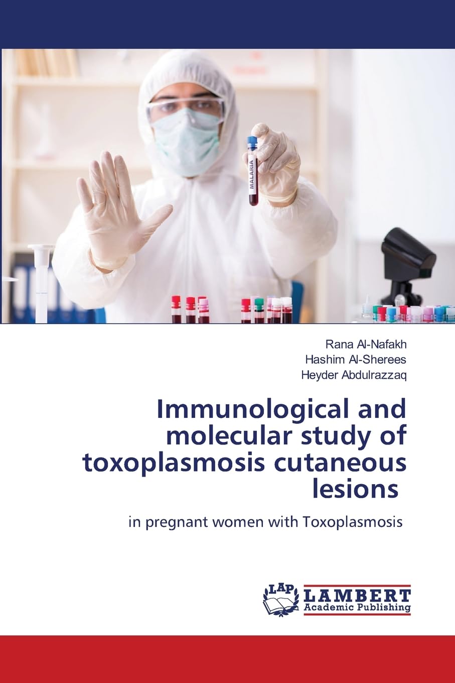 Immunological and molecular study of toxoplasmosis cutaneous lesions Natural Sciences