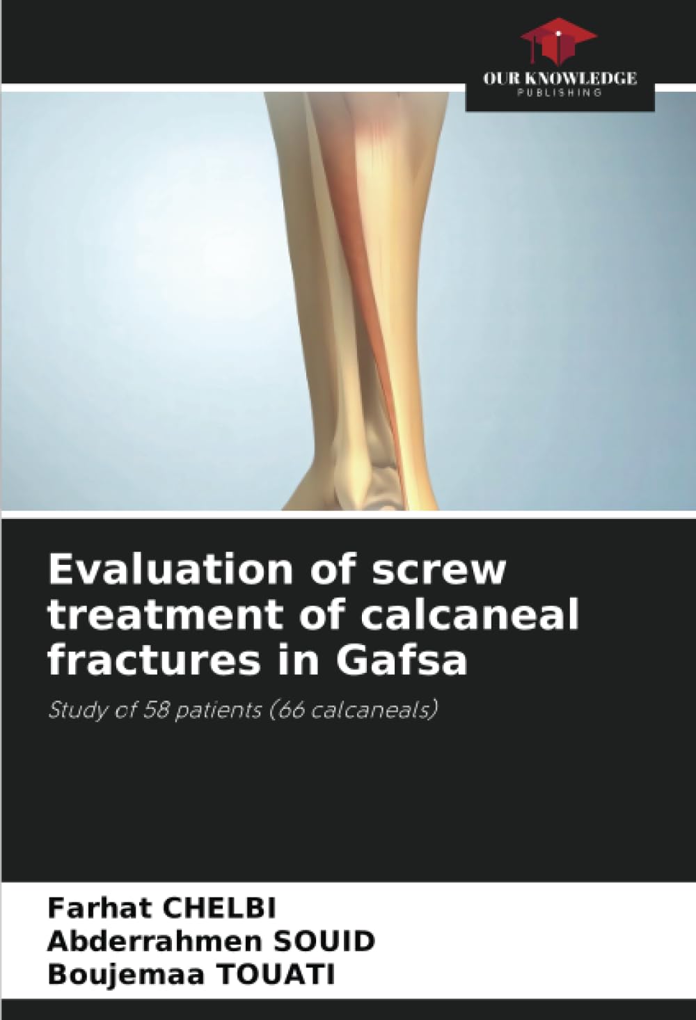 Evaluation of screw treatment of calcaneal fractures in Gafsa Medicine