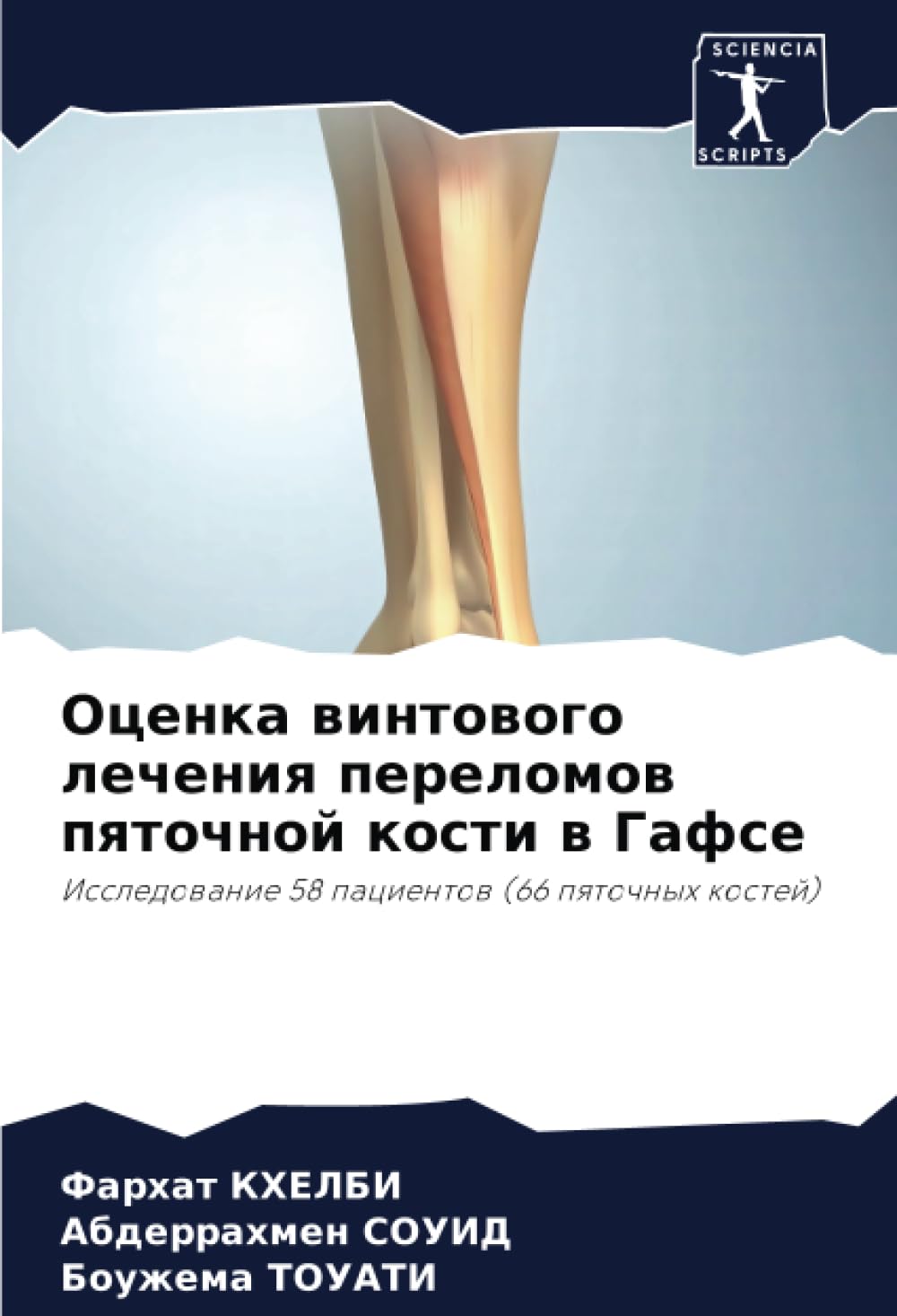 Ocenka wintowogo lecheniq perelomow pqtochnoj kosti w Gafse Medicine