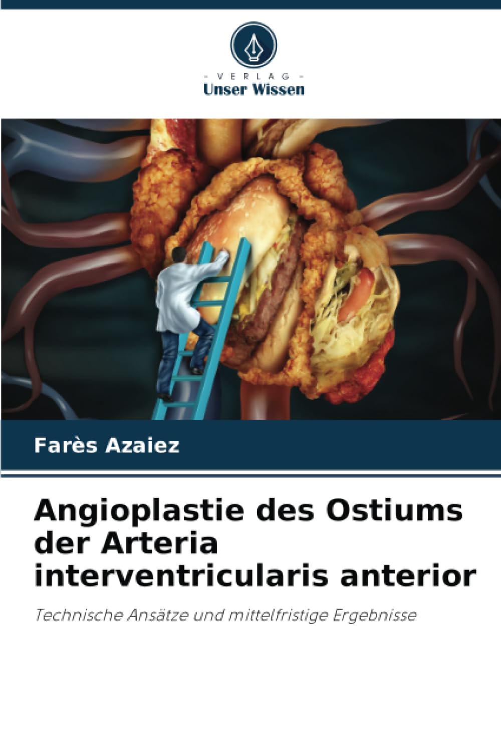 Angioplastie des Ostiums der Arteria interventricularis anterior Medicine