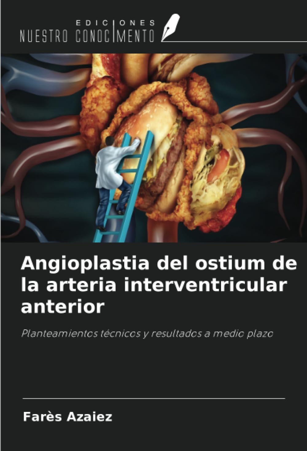 Angioplastia del ostium de la arteria interventricular anterior Medicine