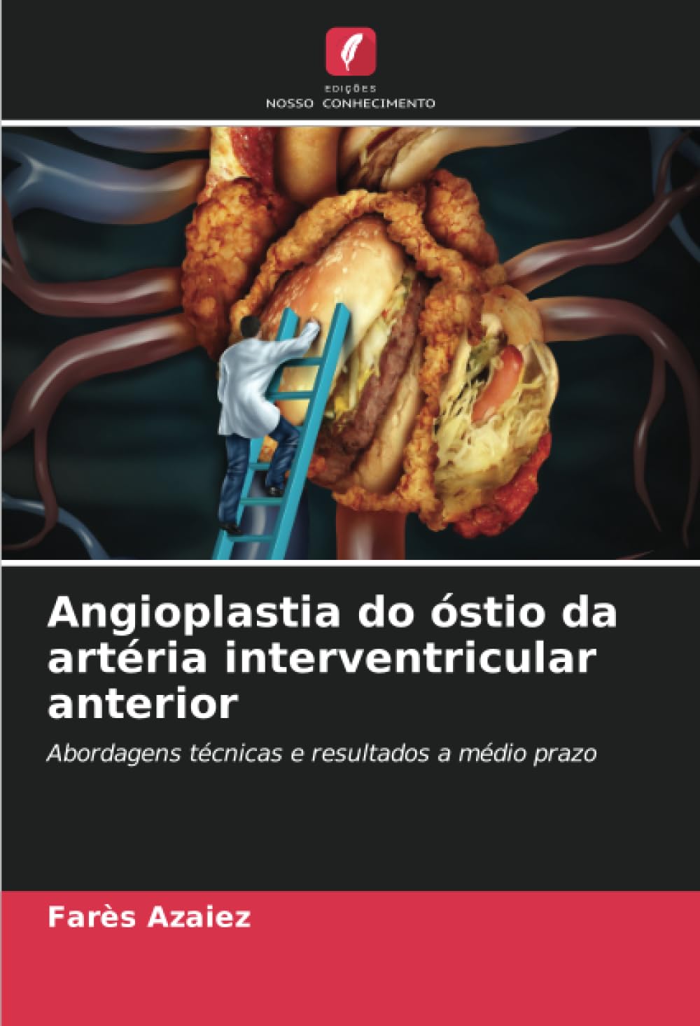 Angioplastia do óstio da artéria interventricular anterior Medicine