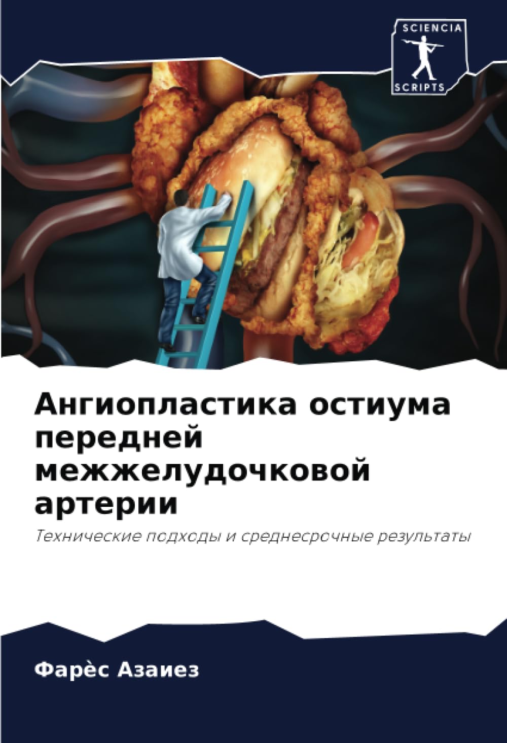 Angioplastika ostiuma perednej mezhzheludochkowoj arterii Medicine