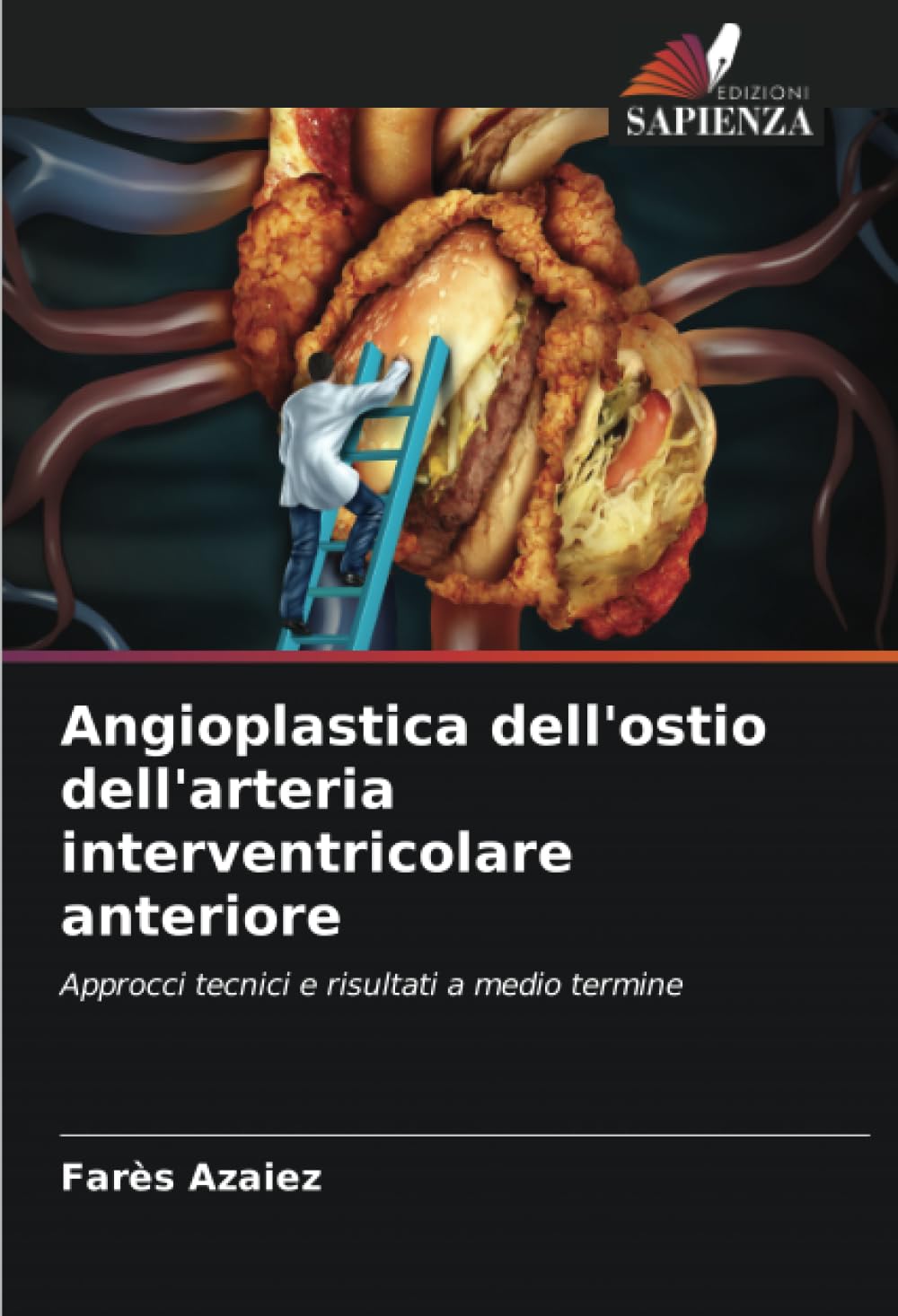 Angioplastica dell'ostio dell'arteria interventricolare anteriore Medicine