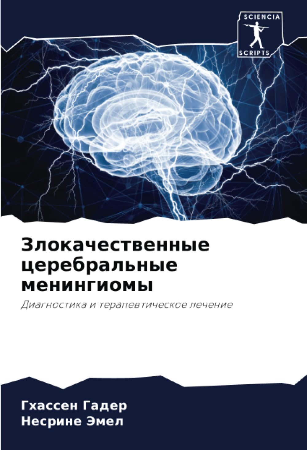 Zlokachestwennye cerebral'nye meningiomy Medicine