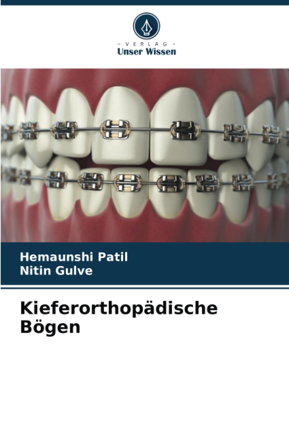 Kieferorthopädische Bögen: DE Medicine