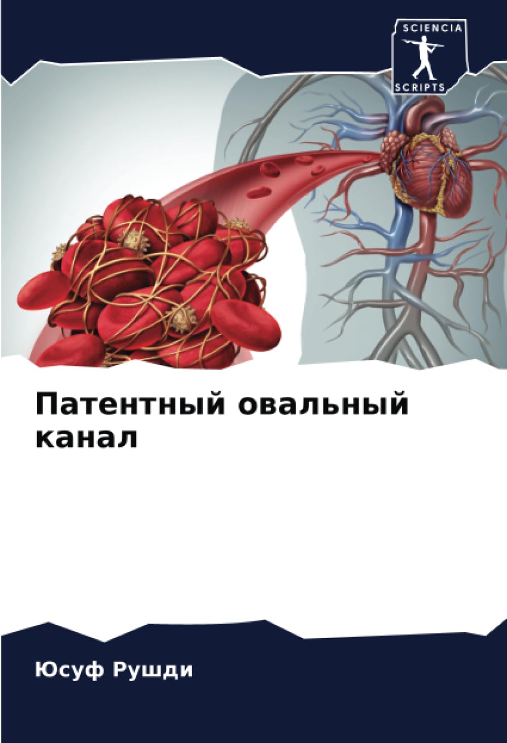 Patentnyj owal'nyj kanal Medicine