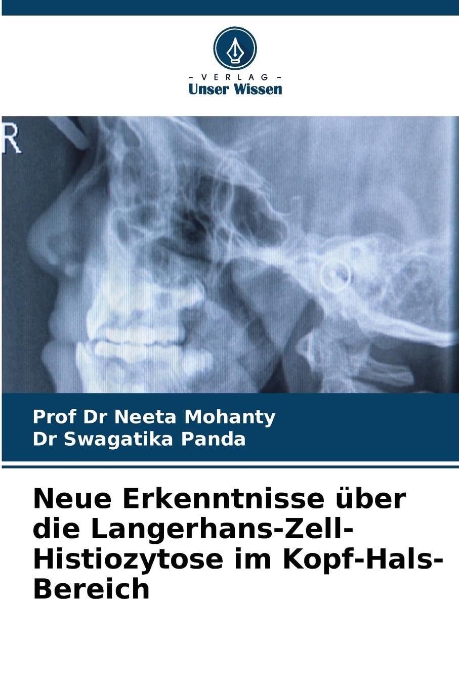 Neue Erkenntnisse über die Langerhans-Zell-Histiozytose im Kopf-Hals-Bereich: DE Medicine