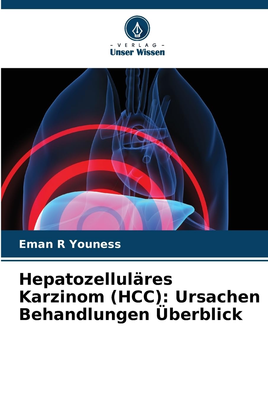 Hepatozelluläres Karzinom (HCC): Ursachen Behandlungen Überblick: DE Law