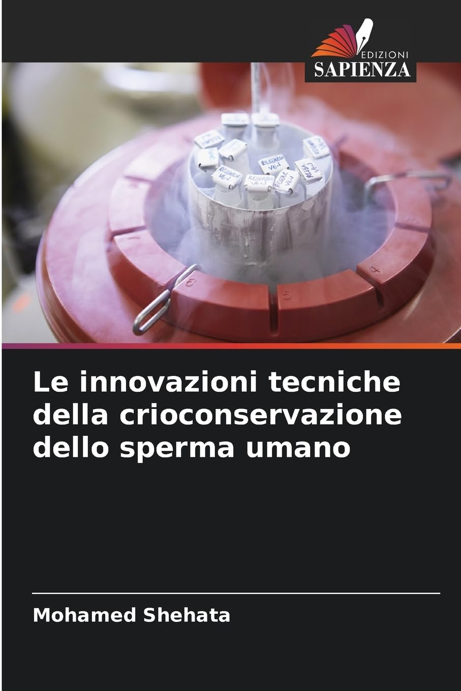 Le innovazioni tecniche della crioconservazione dello sperma umano Medicine