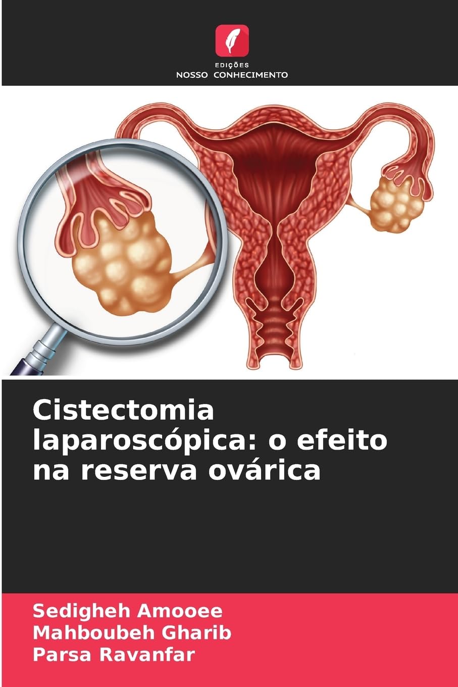 Cistectomia laparoscópica: o efeito na reserva ovárica Medicine