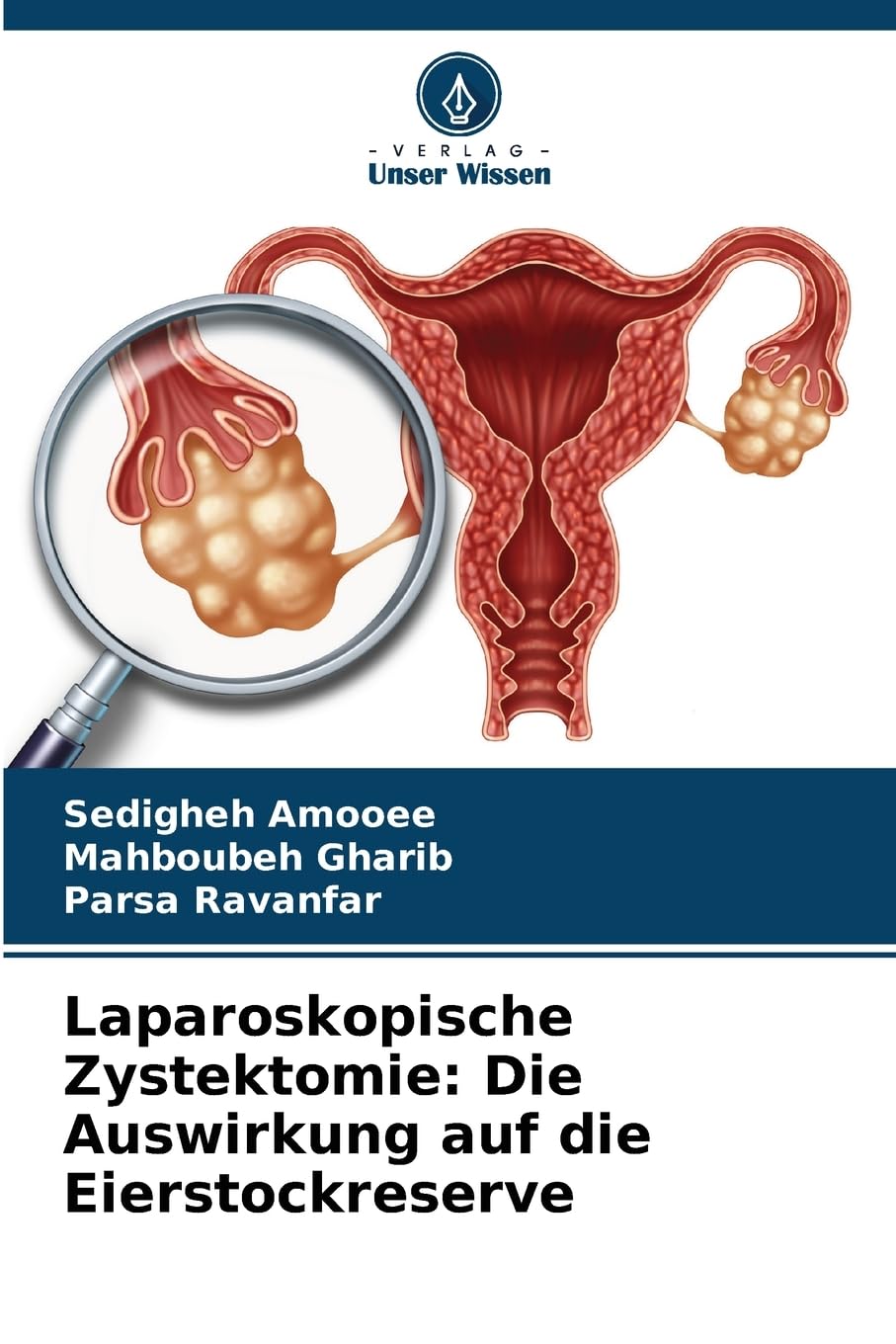 Laparoskopische Zystektomie: Die Auswirkung auf die Eierstockreserve Medicine