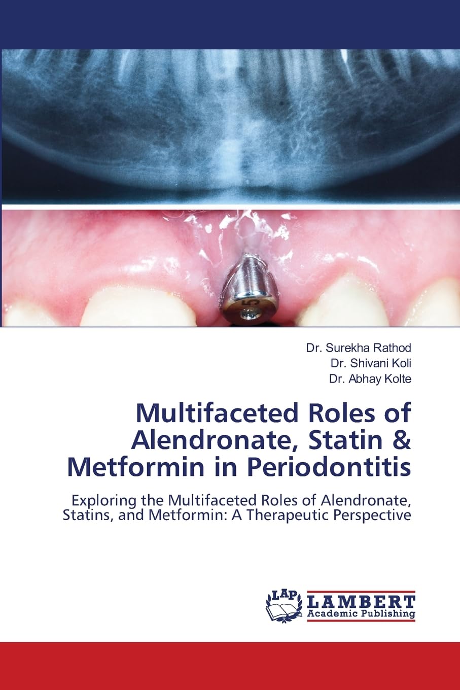 Multifaceted Roles of Alendronate, Statin & Metformin in Periodontitis Medicine