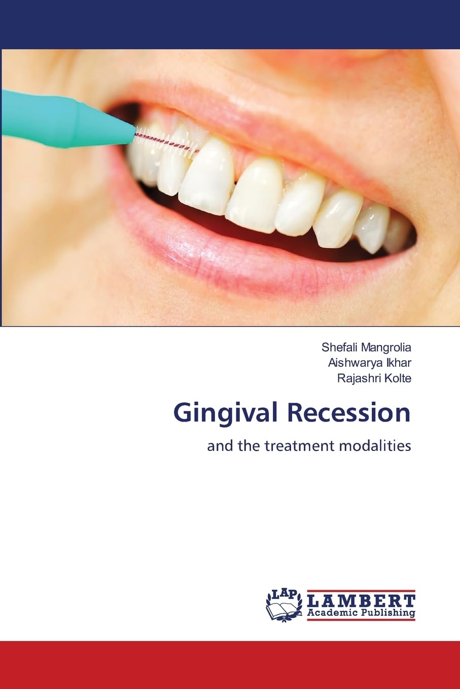 Product Image: Gingival Recession