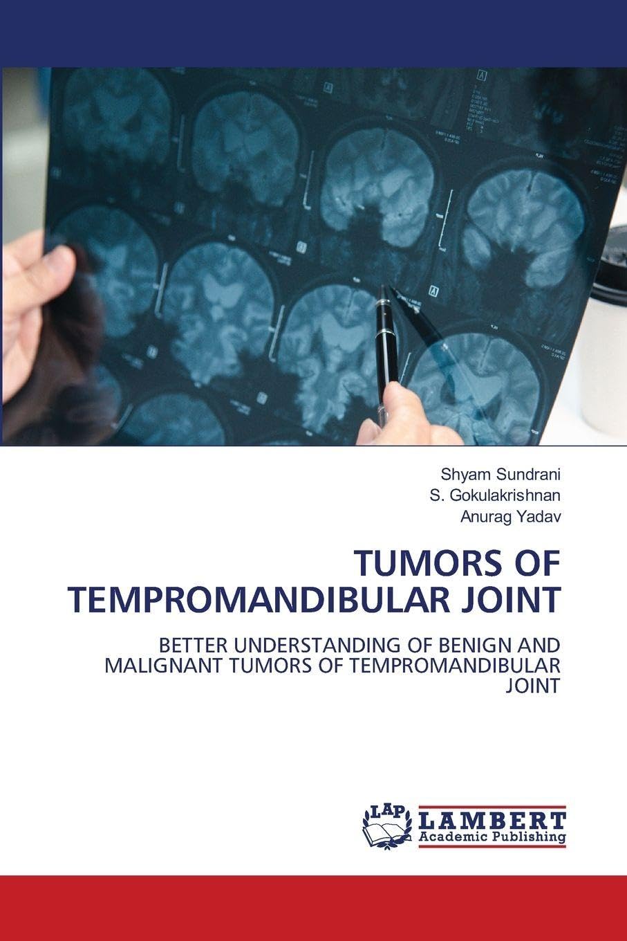 TUMORS OF TEMPROMANDIBULAR JOINT Medicine