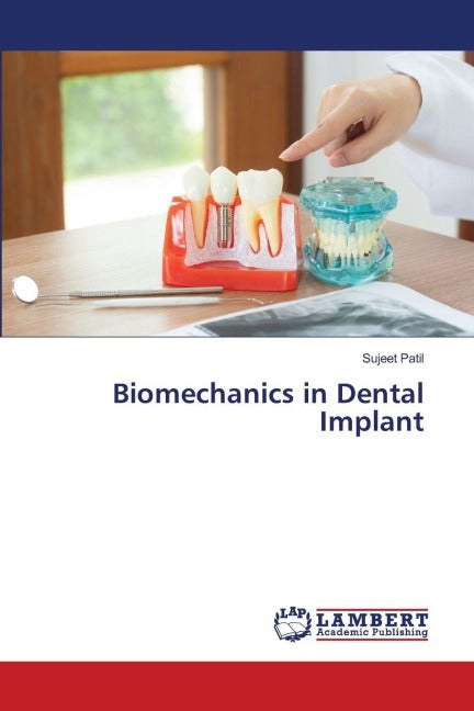 Biomechanics in Dental Implant Medicine
