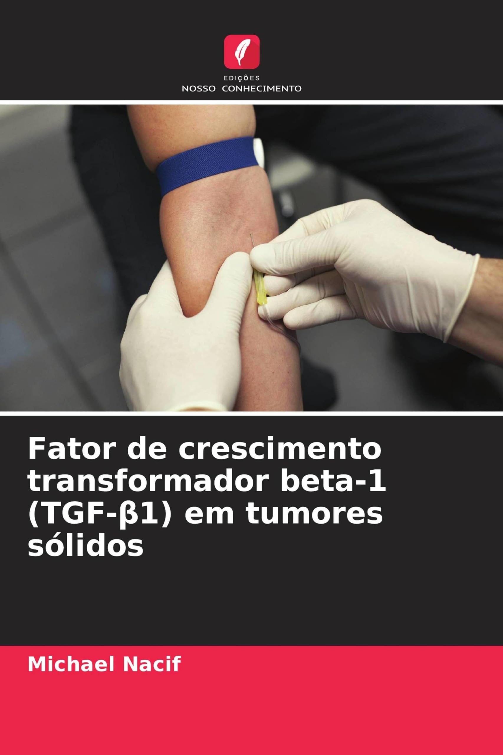 Fator de crescimento transformador beta-1 (TGF-¿1) em tumores sólidos Medicine