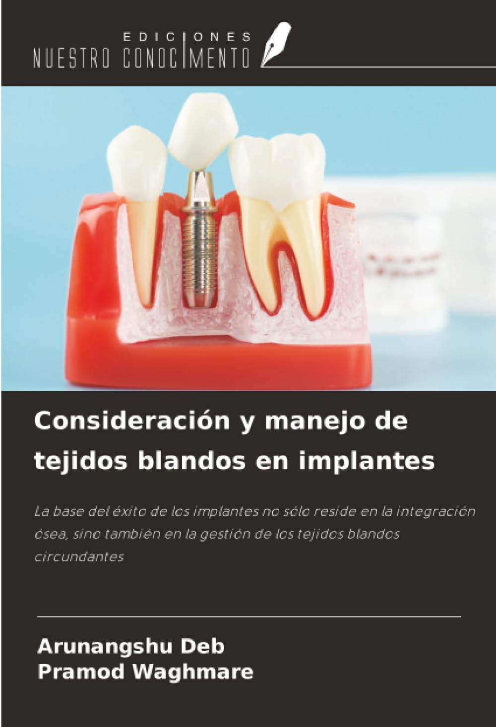 Consideración y manejo de tejidos blandos en implantes Medicine