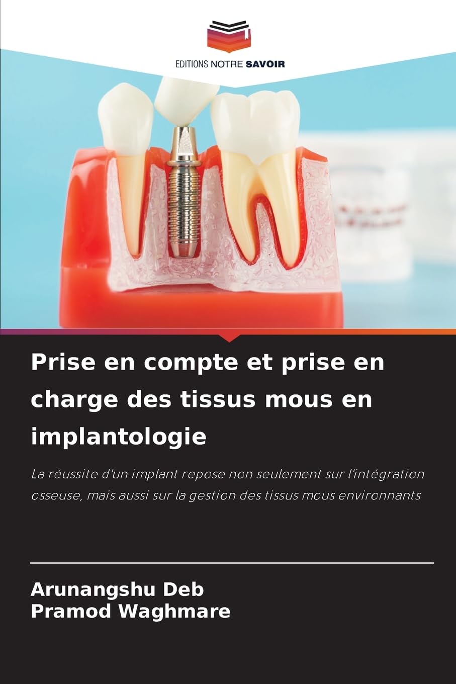 Prise en compte et prise en charge des tissus mous en implantologie: La réussite d'un implant repose non seulement sur l'intégration osseuse, mais aussi sur la gestion des tissus mous environnants Medicine