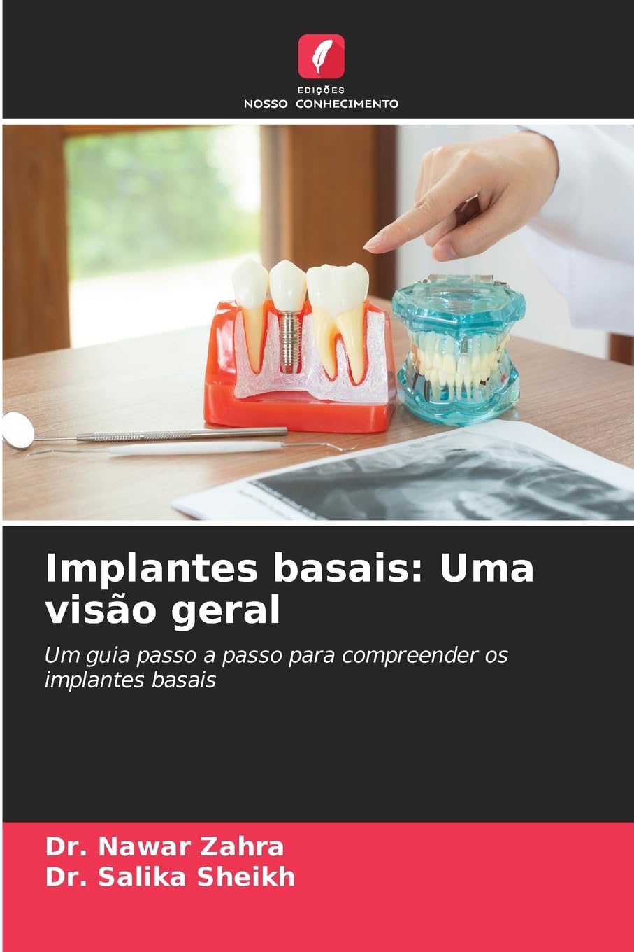 Implantes basais: Uma visão geral Medicine