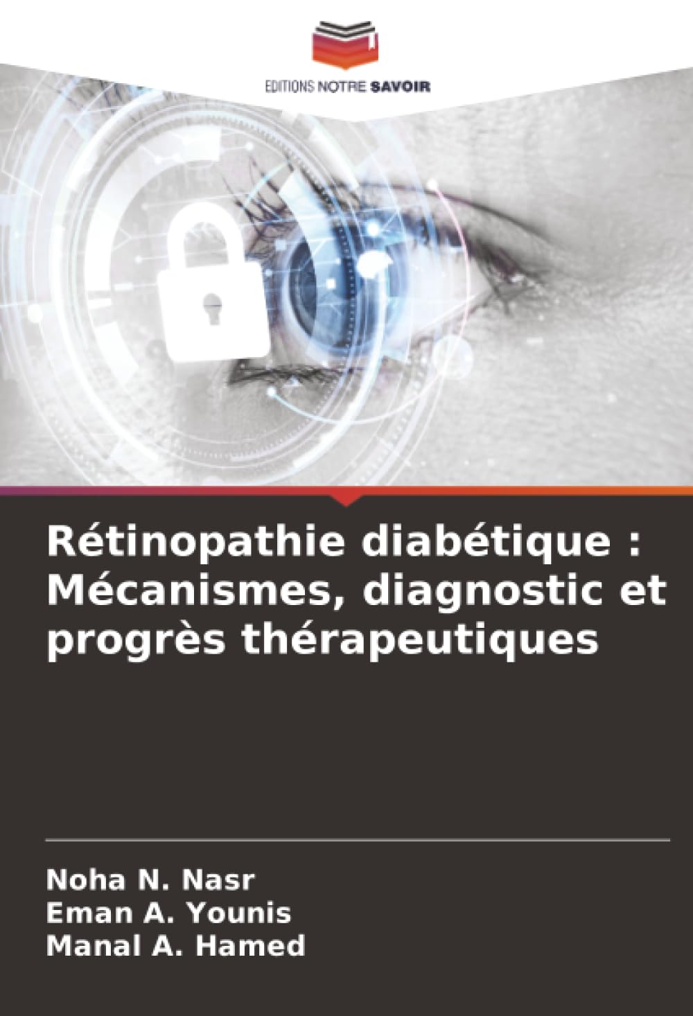 Rétinopathie diabétique : Mécanismes, diagnostic et progrès thérapeutiques Medicine