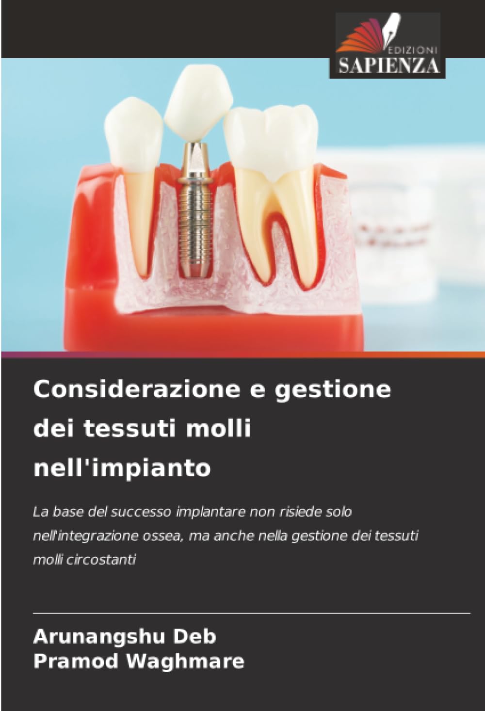 Considerazione e gestione dei tessuti molli nell'impianto Medicine