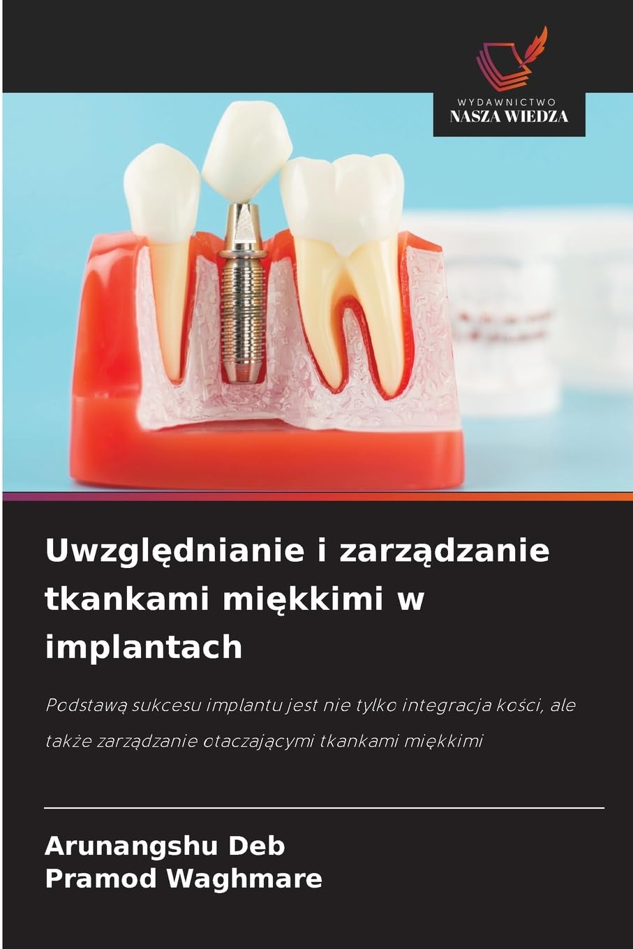 Uwzgl¿dnianie i zarz¿dzanie tkankami mi¿kkimi w implantach Medicine