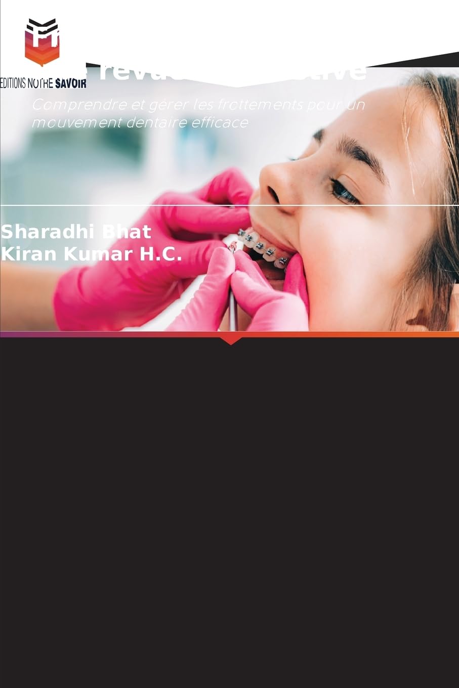 Friction en orthodontie : une revue exhaustive Medicine