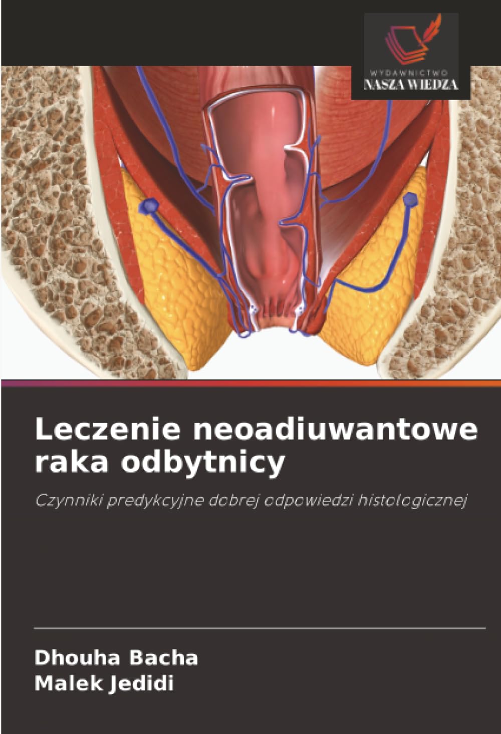 Leczenie neoadiuwantowe raka odbytnicy Medicine