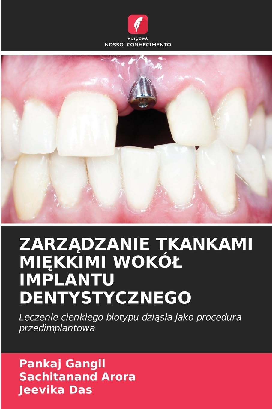 ZARZ¿DZANIE TKANKAMI MI¿KKIMI WOKÓ¿ IMPLANTU DENTYSTYCZNEGO Medicine