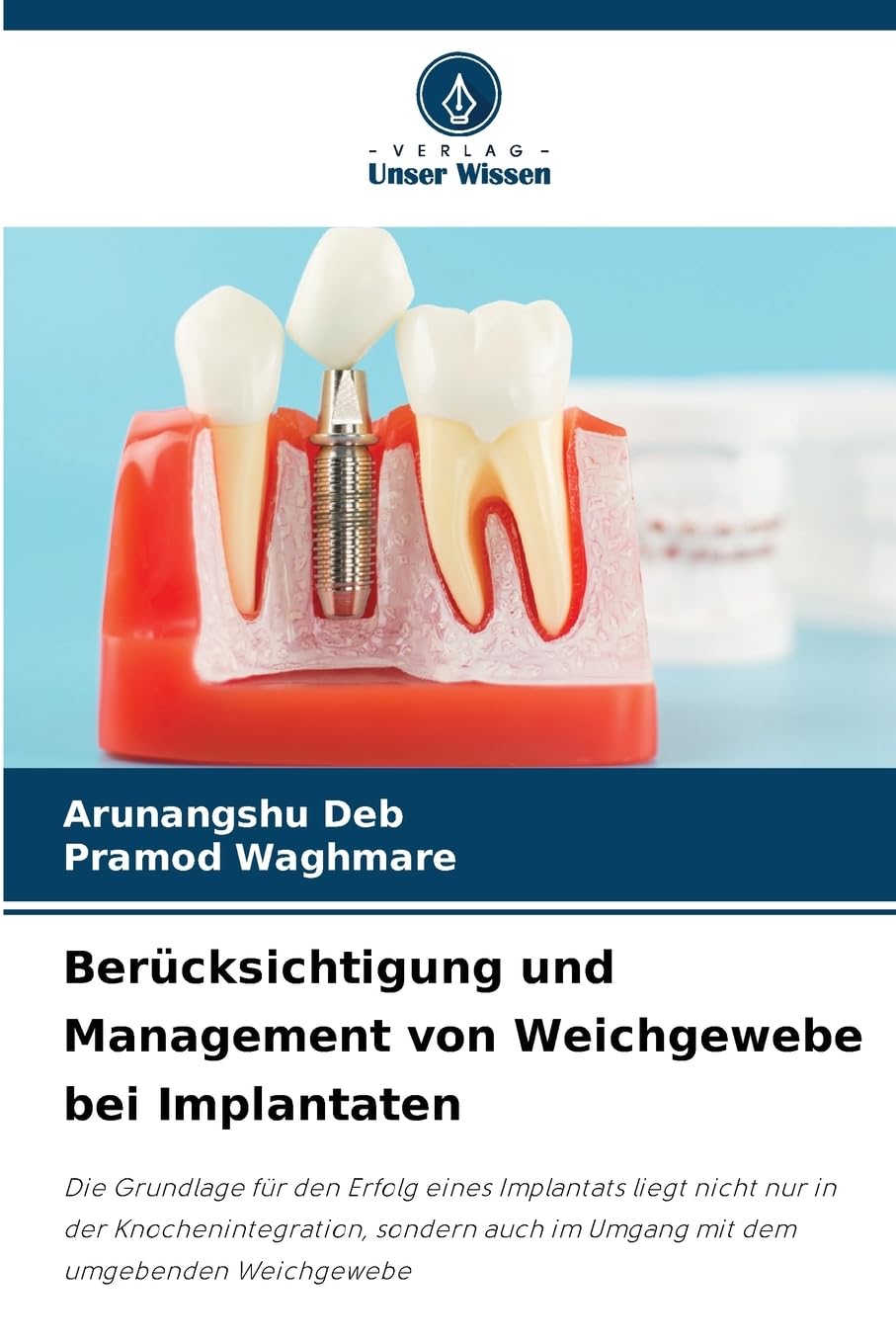 Berücksichtigung und Management von Weichgewebe bei Implantaten Medicine