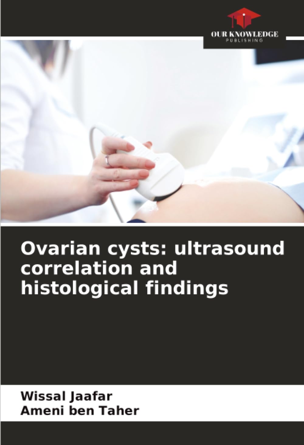Ovarian cysts: ultrasound correlation and histological findings Medicine
