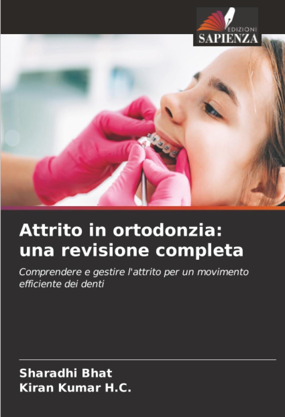 Attrito in ortodonzia: una revisione completa Medicine