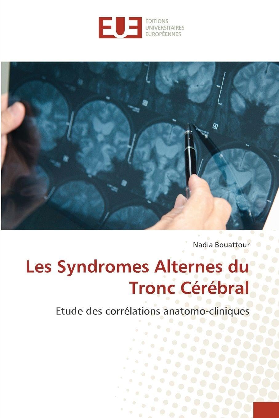 Les Syndromes Alternes du Tronc Cérébral Medicine