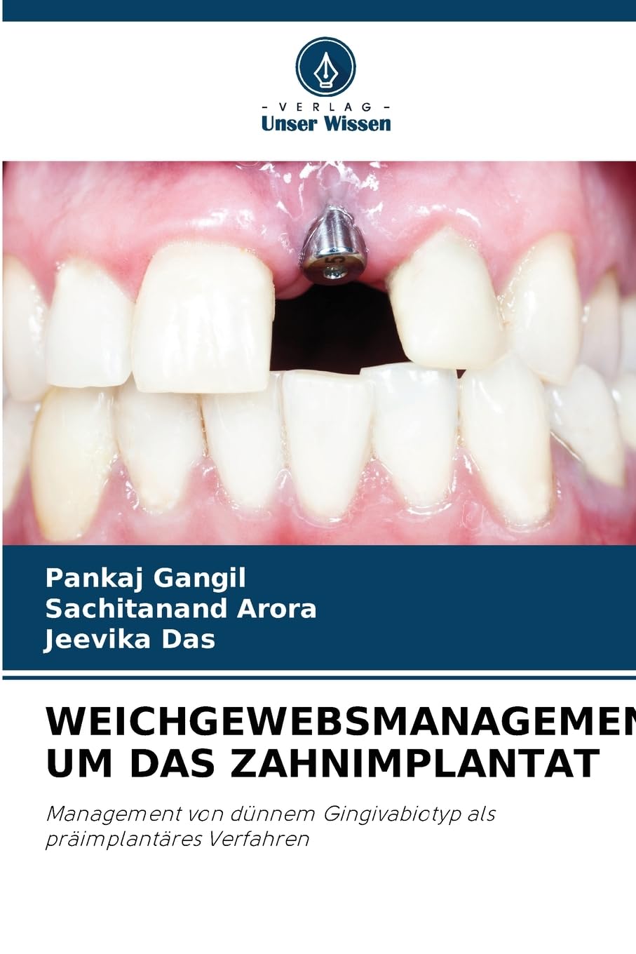 WEICHGEWEBSMANAGEMENT UM DAS ZAHNIMPLANTAT Medicine