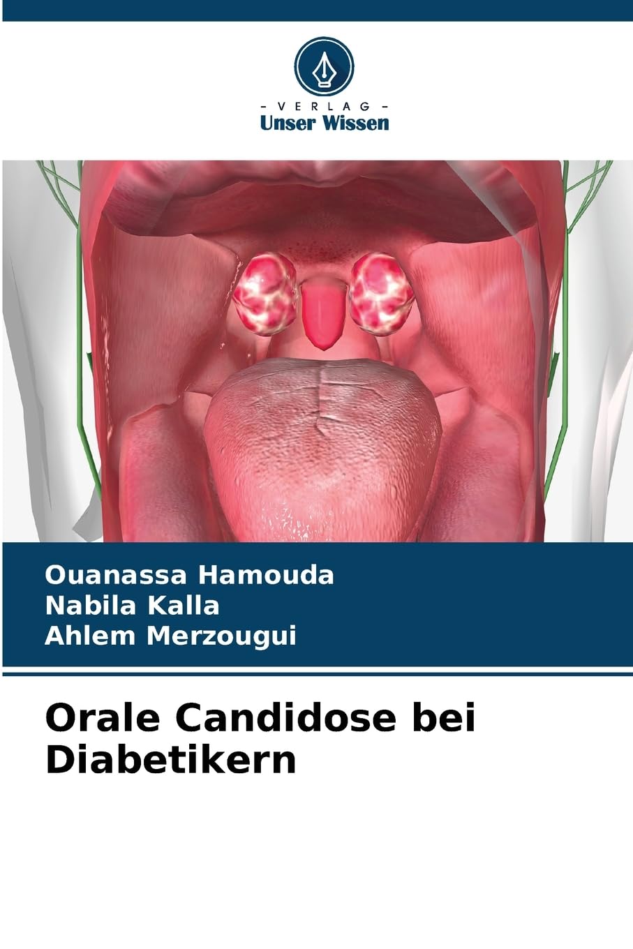 Orale Candidose bei Diabetikern Medicine