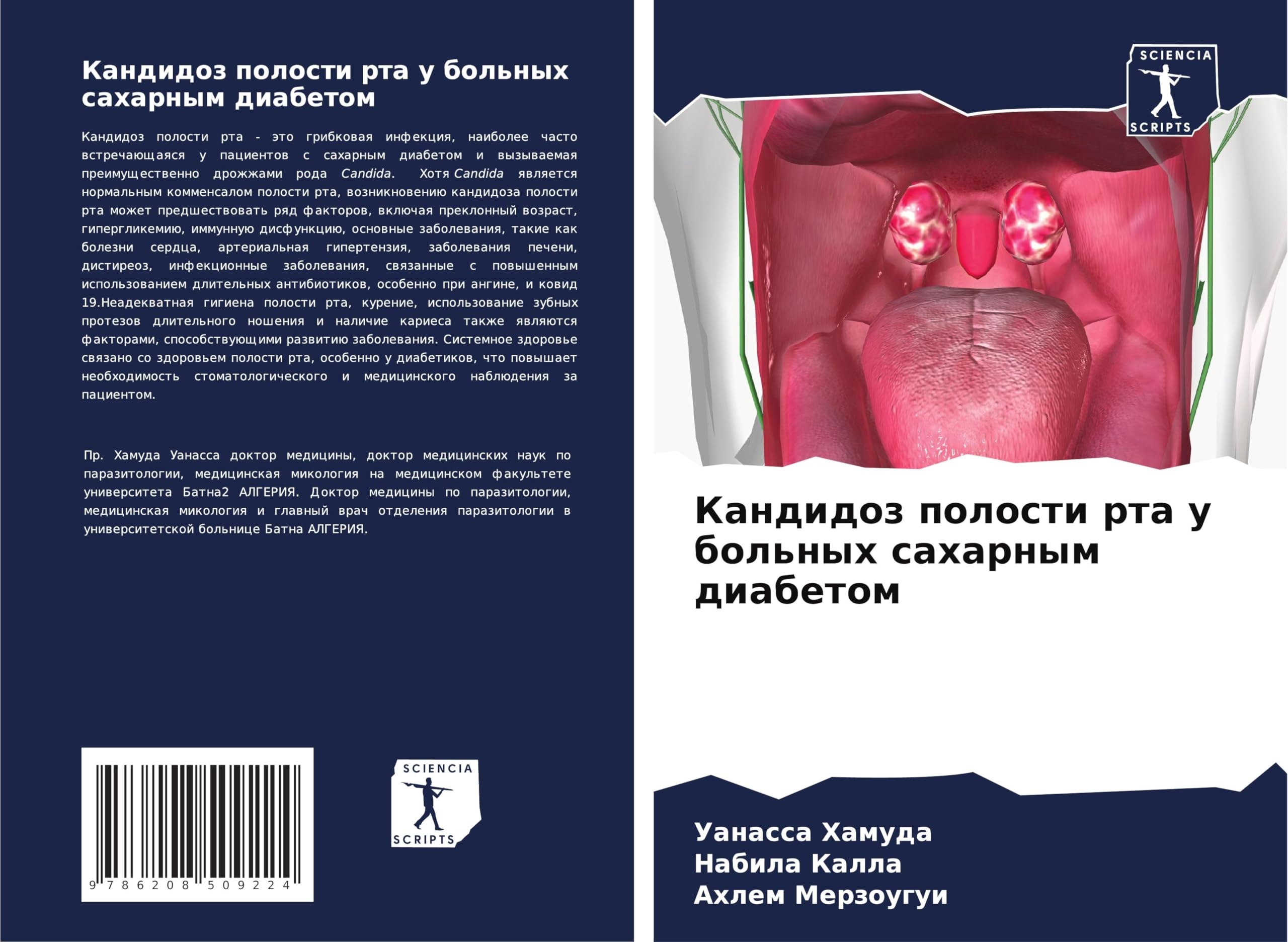 Kandidoz polosti rta u bol'nyh saharnym diabetom Medicine