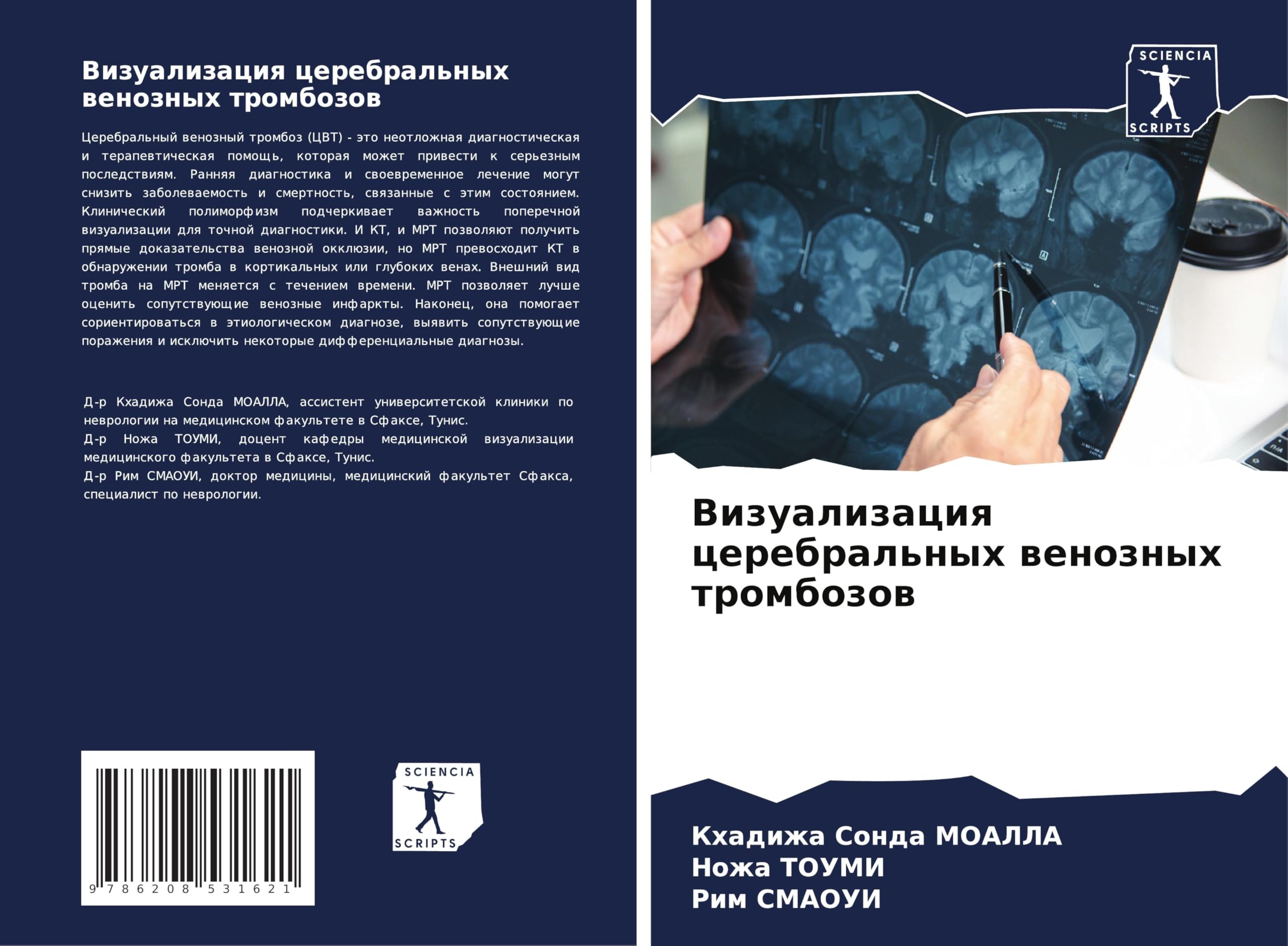 Vizualizaciq cerebral'nyh wenoznyh trombozow Medicine Books
