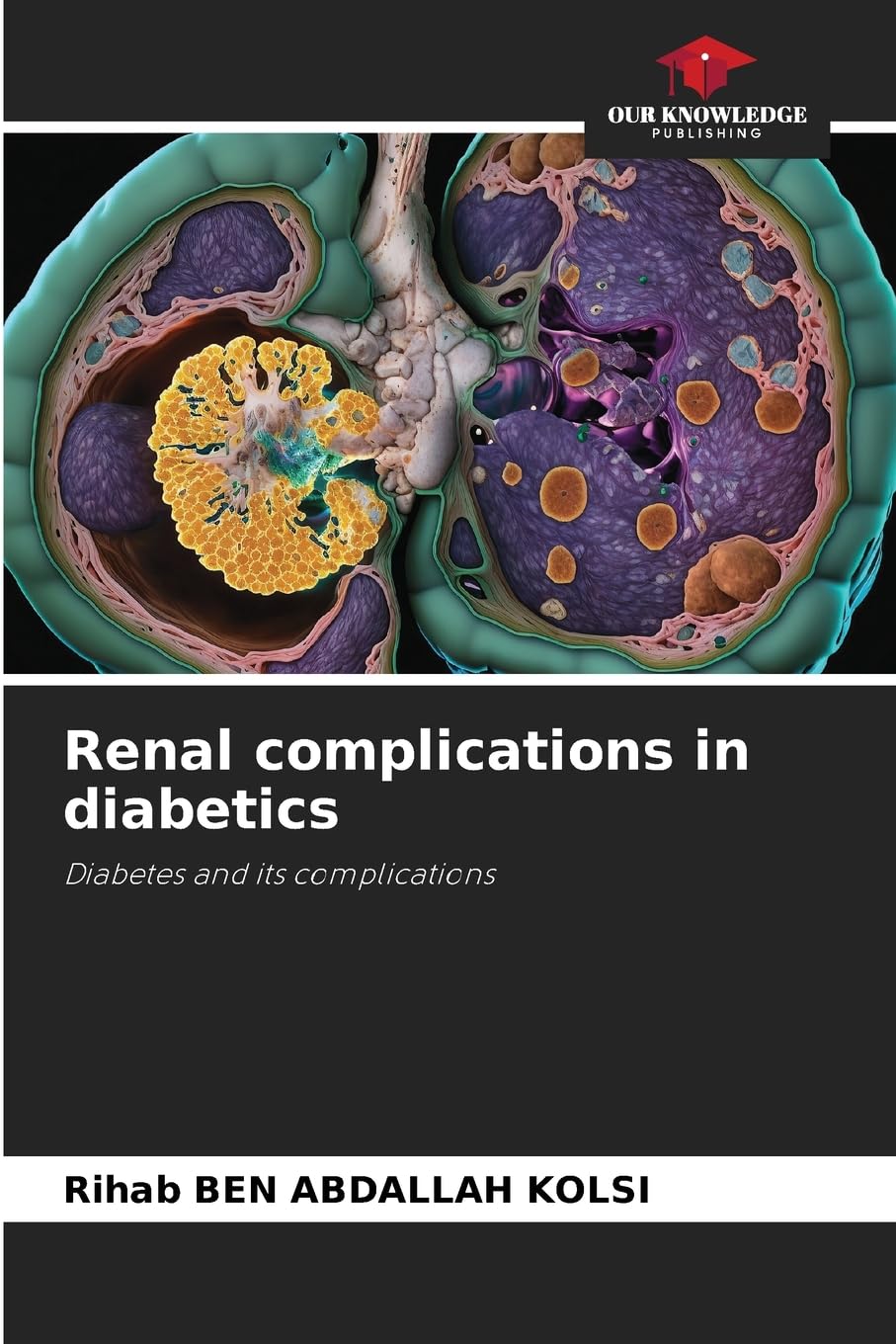 Renal complications in diabetics Medicine