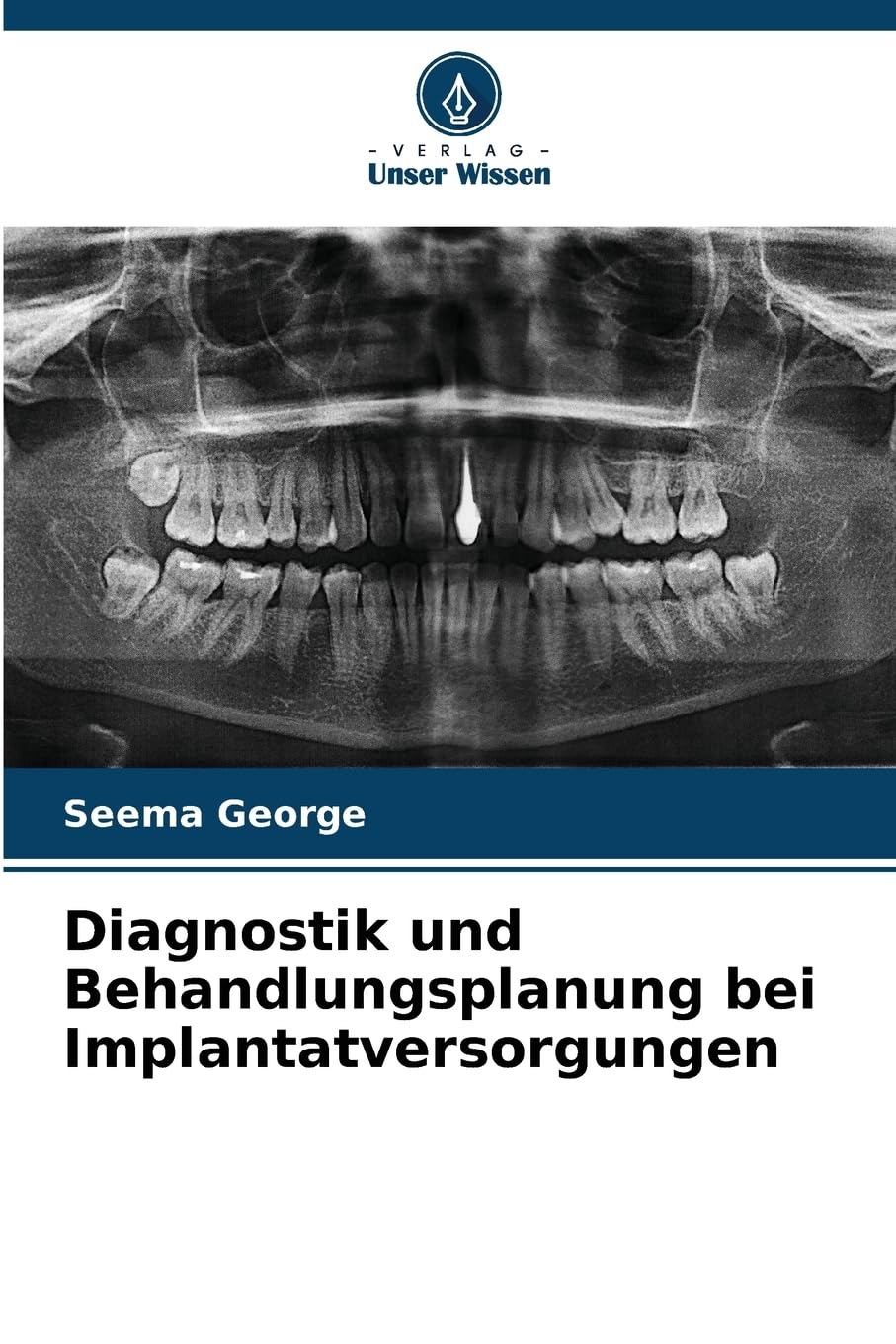 Diagnostik und Behandlungsplanung bei Implantatversorgungen Medicine