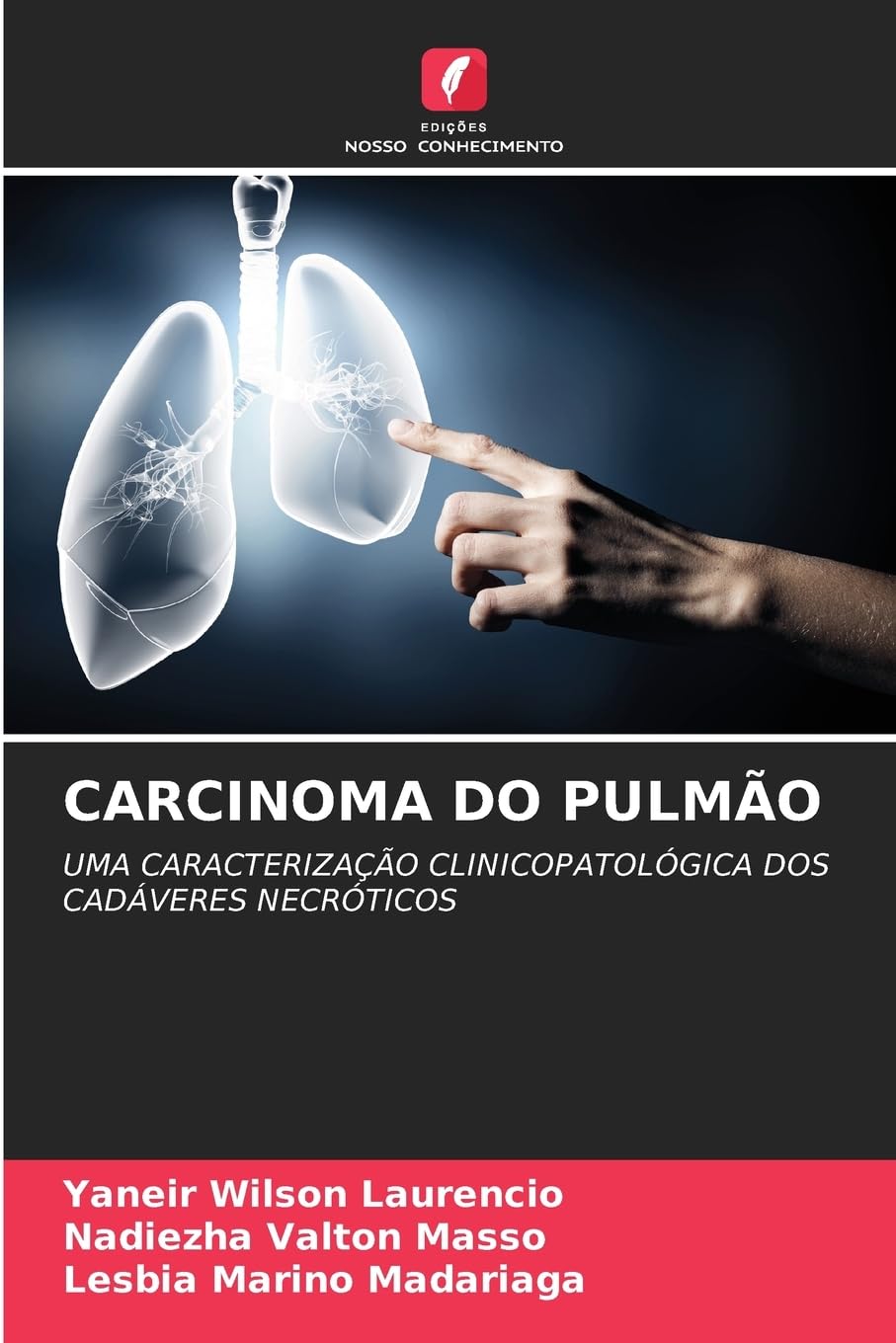 CARCINOMA DO PULMÃO Medicine